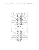 METHOD AND SYSTEM FOR LONGITUDINAL CLOSURE OF DISSECTED STERNUMS diagram and image