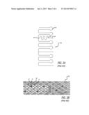 LOW PROFILE STENT WITH FLEXIBLE LINK diagram and image