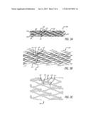 LOW PROFILE STENT WITH FLEXIBLE LINK diagram and image