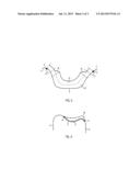 COMPUTER-IMPLEMENTED METHOD FOR DIGITALLY DESIGNING A DENTAL RESTORATION     AND A COMPUTER-READABLE MEDIUM diagram and image