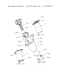 IMPLANTED TONGUE PULLING DEVICE, PULL PLATE, PULL LINE, RETRACTOR AND     METHOD diagram and image