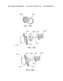 IMPLANTED TONGUE PULLING DEVICE, PULL PLATE, PULL LINE, RETRACTOR AND     METHOD diagram and image