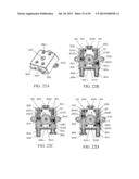 IMPLANTED TONGUE PULLING DEVICE, PULL PLATE, PULL LINE, RETRACTOR AND     METHOD diagram and image