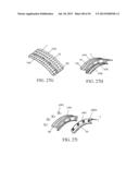 IMPLANTED TONGUE PULLING DEVICE, PULL PLATE, PULL LINE, RETRACTOR AND     METHOD diagram and image