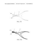 IMPLANTED TONGUE PULLING DEVICE, PULL PLATE, PULL LINE, RETRACTOR AND     METHOD diagram and image