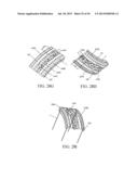 IMPLANTED TONGUE PULLING DEVICE, PULL PLATE, PULL LINE, RETRACTOR AND     METHOD diagram and image