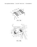 IMPLANTED TONGUE PULLING DEVICE, PULL PLATE, PULL LINE, RETRACTOR AND     METHOD diagram and image