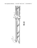 Surgical Instrument diagram and image