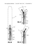 Surgical Instrument diagram and image