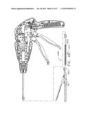 SURGICAL INSTRUMENT diagram and image