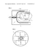 INTEGRATED SHEATH CURRENT FILTER IN A LOCAL COIL diagram and image