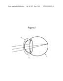 MULTI-FOCAL OPTICAL LENSES diagram and image