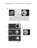 SYSTEMS, METHODS, AND COMPUTER READABLE STORAGE MEDIA  STORING     INSTRUCTIONS FOR GENERATING AN IMAGE INTEGRATING FUNCTIONAL,     PHYSIOLOGICAL AND ANATOMICAL IMAGES diagram and image