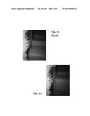 Grinding Ring with Dual Function Grinding Segments diagram and image