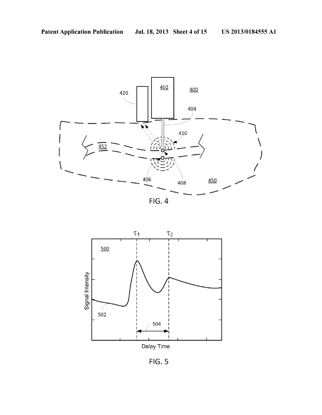 ORAL CAVITY MOUNTED PHOTOACOUSTIC SENSING UNIT - diagram, schematic, and image 05