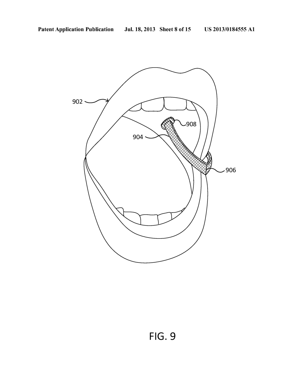 ORAL CAVITY MOUNTED PHOTOACOUSTIC SENSING UNIT - diagram, schematic, and image 09