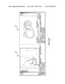 Method for producing an electrophysiological map of the heart diagram and image