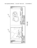 Method for producing an electrophysiological map of the heart diagram and image