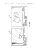 Method for producing an electrophysiological map of the heart diagram and image