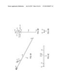 TARGETING IMPLANT FOR EXTERNAL BEAM RADIATION diagram and image