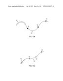 TARGETING IMPLANT FOR EXTERNAL BEAM RADIATION diagram and image