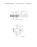 METHODS, SYSTEMS, AND DEVICES FOR RESIZABLE INTRA-ATRIAL SHUNTS diagram and image