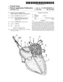 APPARATUS AND METHOD FOR INTRA-CARDIAC MAPPING AND ABLATION diagram and image