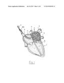 APPARATUS AND METHOD FOR INTRA-CARDIAC MAPPING AND ABLATION diagram and image