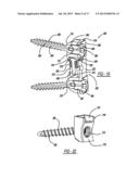 DISC DISTRACTION DEVICE diagram and image