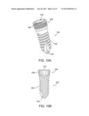 MULTI-AXIAL BONE PLATE FIXATION diagram and image