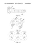 MULTI-AXIAL BONE PLATE FIXATION diagram and image