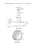 MULTI-AXIAL BONE PLATE FIXATION diagram and image