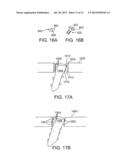 MULTI-AXIAL BONE PLATE FIXATION diagram and image