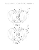 FIXED-BEARING KNEE PROSTHESIS HAVING INTERCHANGEABLE COMPONENTS diagram and image