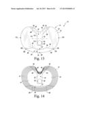 FIXED-BEARING KNEE PROSTHESIS HAVING INTERCHANGEABLE COMPONENTS diagram and image