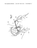 DENTAL INSTRUMENT FOR CLEANING TEETH diagram and image