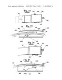 DENTAL INSTRUMENT FOR CLEANING TEETH diagram and image