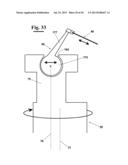 DENTAL INSTRUMENT FOR CLEANING TEETH diagram and image