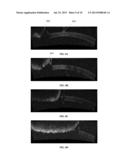 SYSTEMS AND METHODS FOR ENHANCED ACCURACY IN OCT IMAGING OF THE CORNEA diagram and image