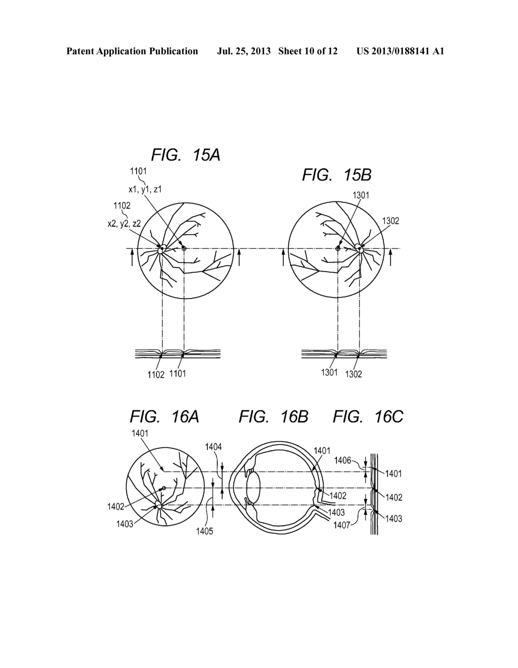 IMAGE PROCESSING APPARATUS, IMAGE PROCESSING METHOD, AND PROGRAM - diagram, schematic, and image 11