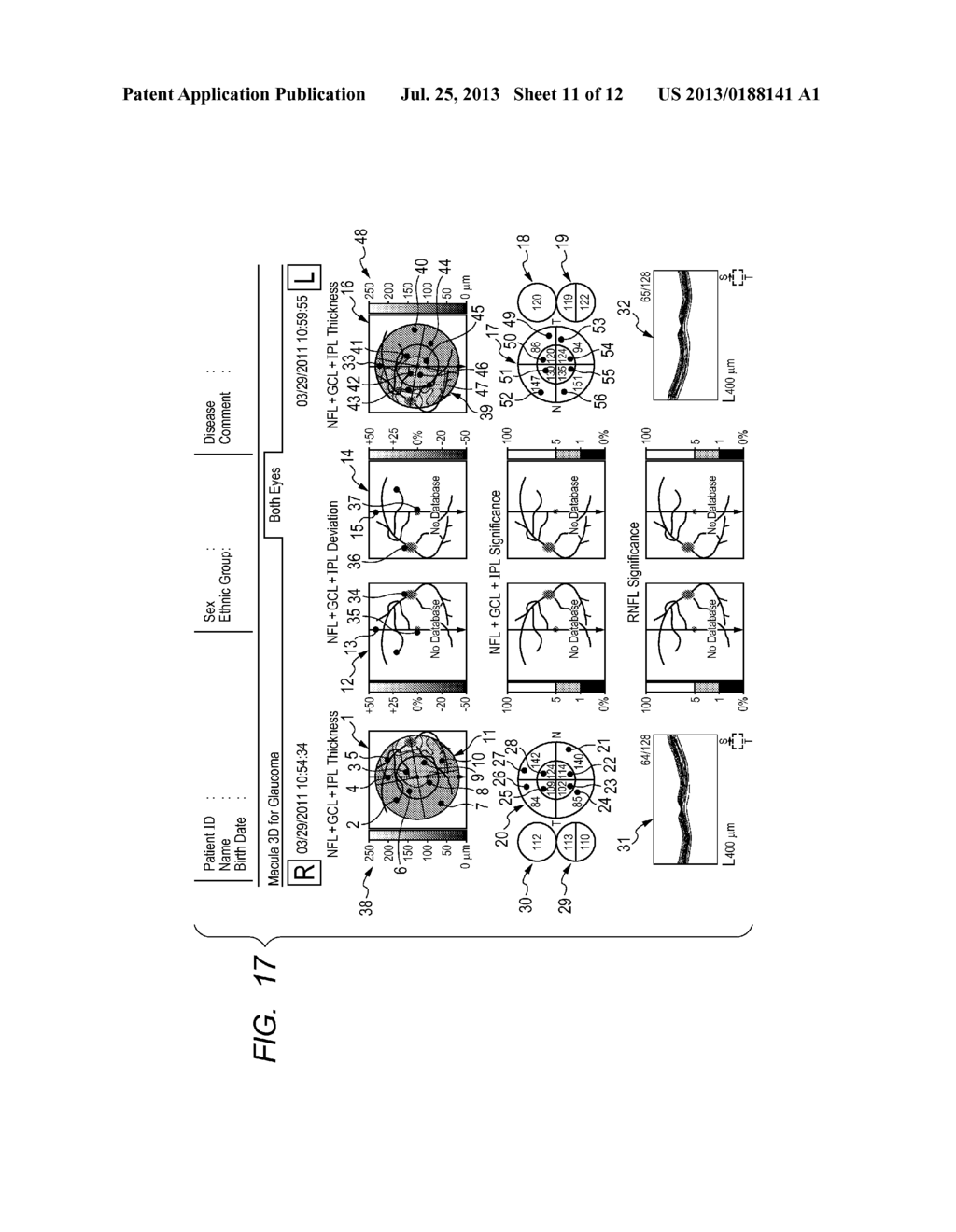 IMAGE PROCESSING APPARATUS, IMAGE PROCESSING METHOD, AND PROGRAM - diagram, schematic, and image 12