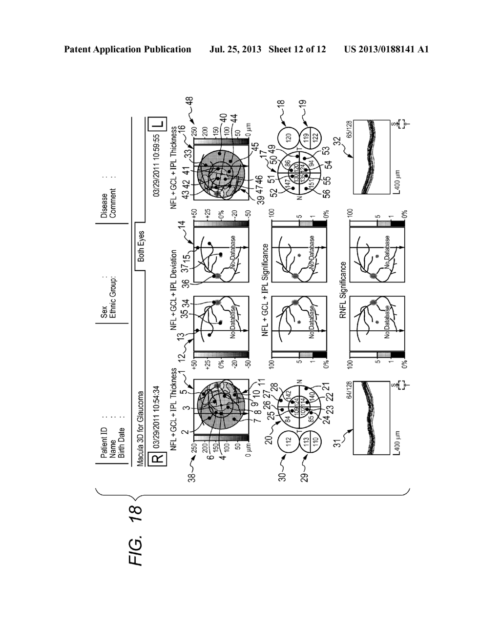 IMAGE PROCESSING APPARATUS, IMAGE PROCESSING METHOD, AND PROGRAM - diagram, schematic, and image 13