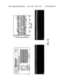 LATERAL DISTORTION CORRECTED OPTICAL COHERENCE TOMOGRAPHY SYSTEM diagram and image