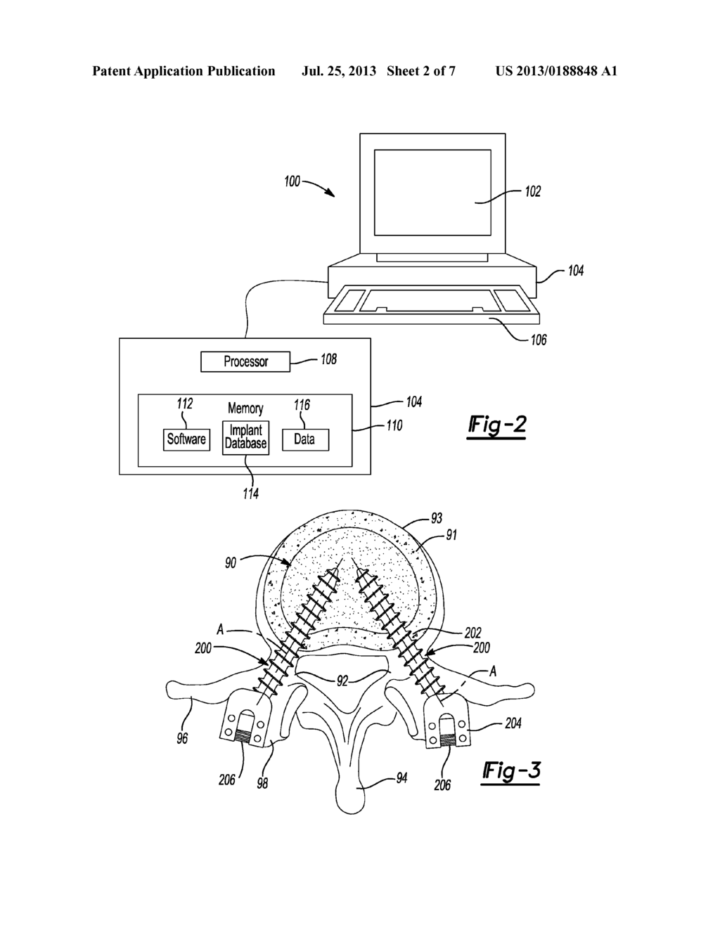 Automatic Implant Detection From Image Artifacts - diagram, schematic, and image 03