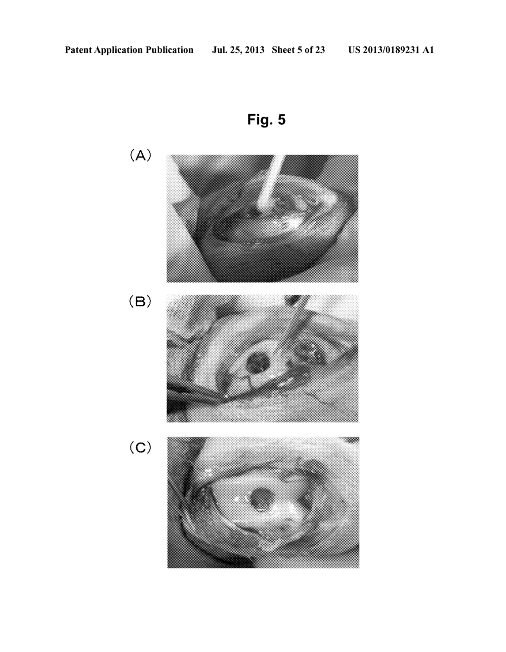 COMPOSITION FOR TREATMENT OF CARTILAGE DISEASE - diagram, schematic, and image 06