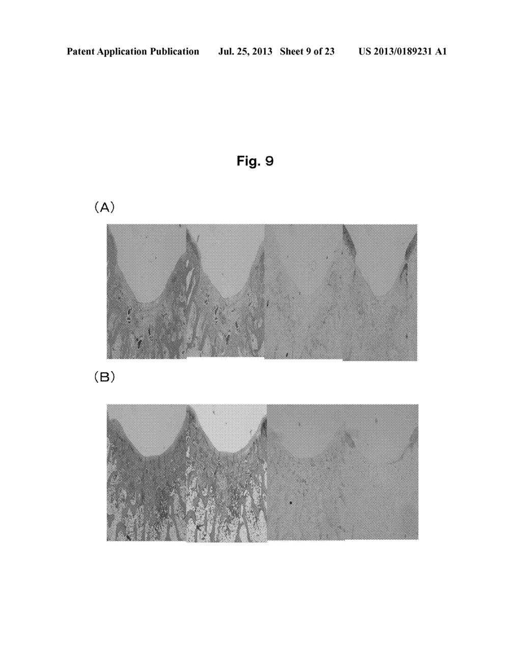 COMPOSITION FOR TREATMENT OF CARTILAGE DISEASE - diagram, schematic, and image 10