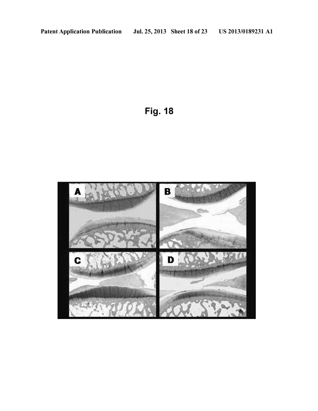 COMPOSITION FOR TREATMENT OF CARTILAGE DISEASE - diagram, schematic, and image 19