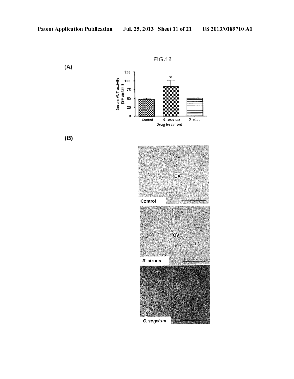 Method And Assay Kit For Detection Of Toxicity Induced By Pyrrolizidine     Alkaloids - diagram, schematic, and image 12