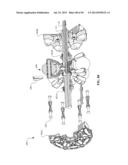 CONTINUOUSLY VARIABLE TRANSMISSION diagram and image