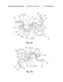 PLANETARY GEAR SYSTEM, PLANETARY DIFFERENTIAL AND GEAR SYSTEM WITH THE     PLANETARY DIFFERENTIAL diagram and image